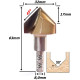 Anterior