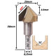 Anterior